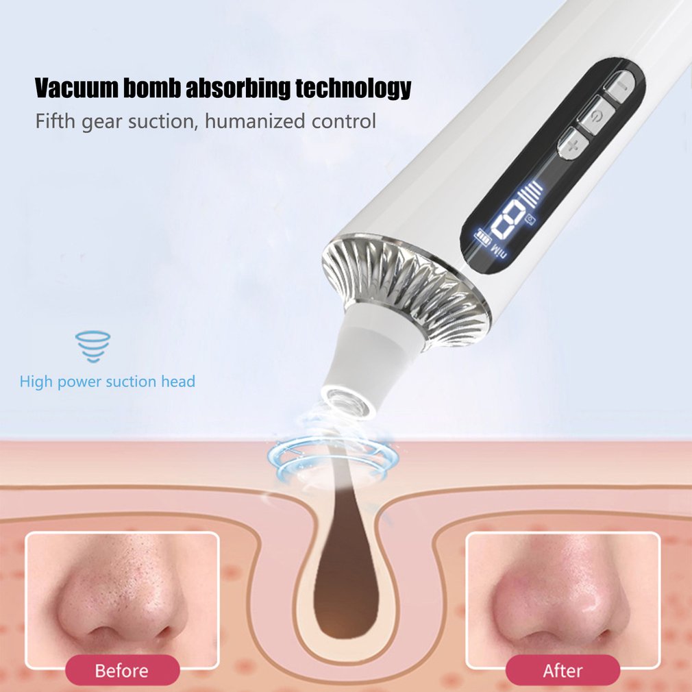 PorePerfect Electric Blackhead Vacuum